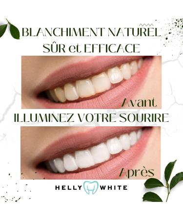Dentifrice Professionnel Blanchissant Naturel Charbon Actif Huile de Coco Menthe Pack 2 sans Fluor Dents Blanches Sp cial Gencives Sensibles - Buy Online on GoSupps.com