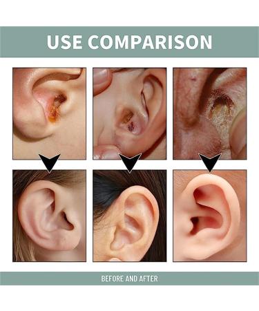 EXQST Anti-Tinnitus & Earwax Removal Spray - Natural Cochlea Cleaner | Relieve Tinnitus & Unclog Ears - 1 Pcs - Buy Online on GoSupps.com
