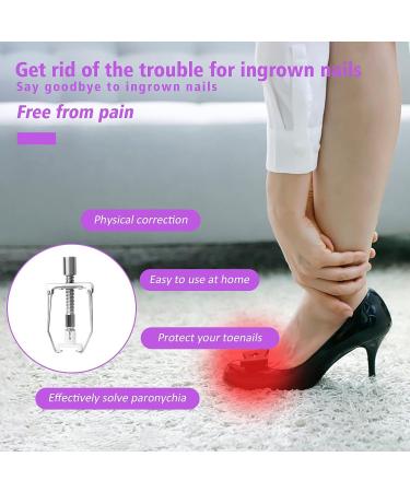 Professional Ingrown Toenail Treatment Kit - Includes Corrector Tool, Nail Lifter, Retainers, Patches, Strips - Buy Online on GoSupps.com