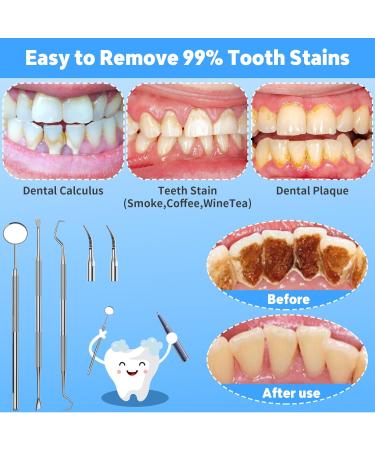 Sunlary Tartar Remover Ultrasound - 5 Cleaning Modes for Dogs Cats & Humans | Combat Tartar Bad Breath & Gum Infections - Buy Online on GoSupps.com