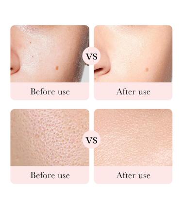 Rose Day Face Cream - Natural Rose Oil & Hyaluronic Acid Moisturizer for Dry Skin | Revitalizing & Firming - Buy Online on GoSupps.com