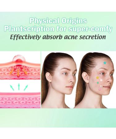 Star Pimple Patches (240 Counts) - Hydrocolloid Acne Dots with Tea Tree Oil in 3 Sizes & 6 Colors for Effective Blemish Removal - Buy Online on GoSupps.com