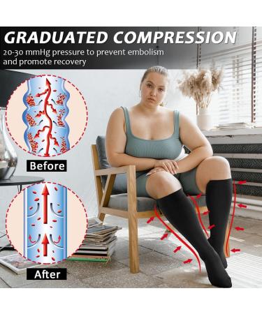 Ailaka Compression Stockings with Zip for Men & Women 20-30 mmHg Medical Class 2 Support Socks for Varicose Veins Edema Recovery 3X Large Black (1 Pair) - Buy Online on GoSupps.com