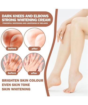 Strong whitening cream for dark knees and elbows The most popular whitening cream in 2023 Dark spot correcting cream Whitening cream for the intimate area Moisturizing the skin - Buy Online on GoSupps.com