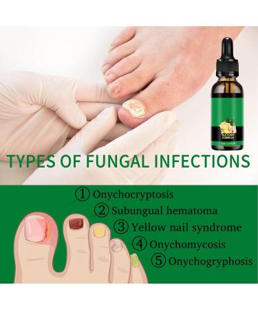 Organic Nail Growth Oil 60ml Portable Strengthener Professional Cuticle Care Solution Toenail Repair Liquid Repairing and Thickening Formula for Healthy Nails - Buy Online on GoSupps.com