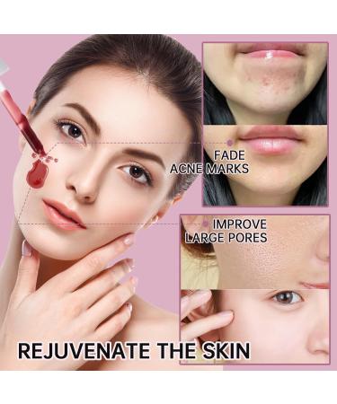 Peeling Solution AHA 30% + BHA 2% | Exfoliating Facial Serum for Acne | Reduce Pores & Fine Lines - 30ML - Buy Online on GoSupps.com
