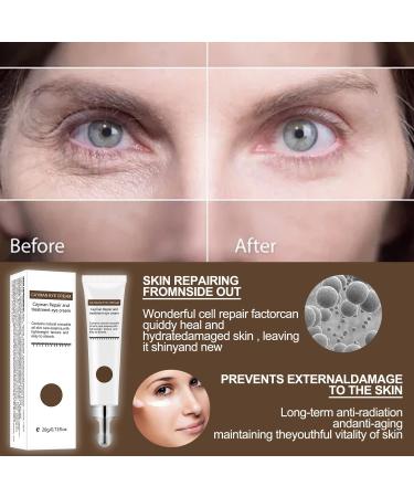 2pcs Silk Protein Anti-Aging Eye Cream for Wrinkles, Dark Circles, Fine Lines - Firming & Repair Eye Serum - Buy Online on GoSupps.com
