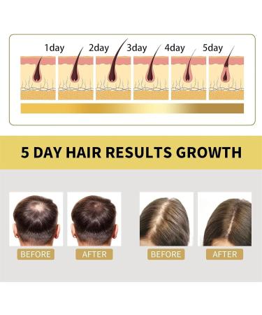 8 Minute Ginseng Shampoo Nourishing Shampoo with Ginseng Root Extract Korean Golden Ginseng Hair Lotion Anti Hair Loss Shampoo for Stronger Smoother and Softer Hair. - Buy Online on GoSupps.com