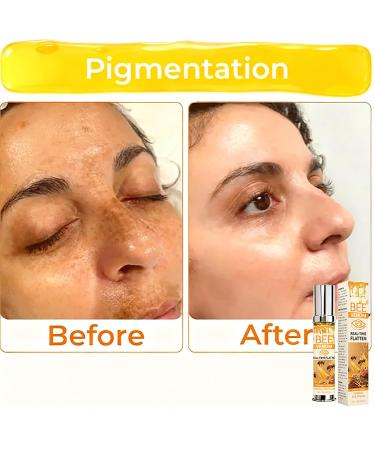 Helbr Bee Venom Firming Eye Cream 2PCS Anti-Aging Firming Lifting & Hydrating Bee Venom Cream for All Skin Types Bee Venom Skin Treatment to Reduce Wrinkles and Fine Lines 1.04oz - Buy Online on GoSupps.com