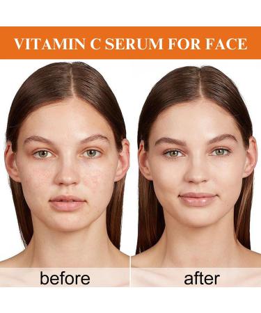 Vitamin C Serum with Collagen Vitamin C Serum for Face Vitamin C Serum Natural Anti Aging & Wrinkle Facial Serum Vitamin C Collagen Serum Brightening Serum Improve Dull Tired Skin 50ml - Buy Online on GoSupps.com