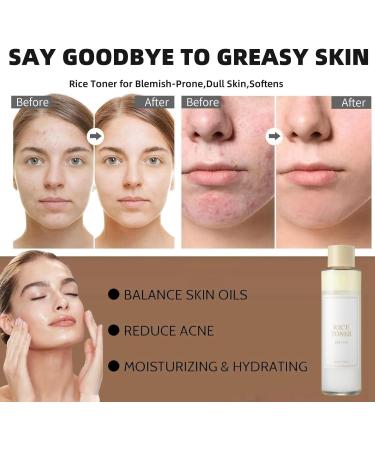 Rice Toner Rice Water Toner for Face Hydrating Toner for Face Korean Toner Skincare Rice Water Toner Soothing Face Natural Glow Essence Toning Facial Essence with Rice Extract Skin Toner 150ml - Buy Online on GoSupps.com
