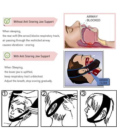 RZMZBY 2PC Anti Snoring Chin Straps | Effective Snoring Solution for Men & Women | Snore Relief & Reduction - Buy Online on GoSupps.com