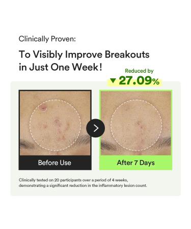 Abib Soothing Acne Care Duo: Heartleaf Teca Capsule Serum Calming Drop & Heartleaf Spot Pad Calming Touch 80pads I Centella Asiatica & Niacinamide Serum Toner Pads for Sensitive Skin - Buy Online on GoSupps.com