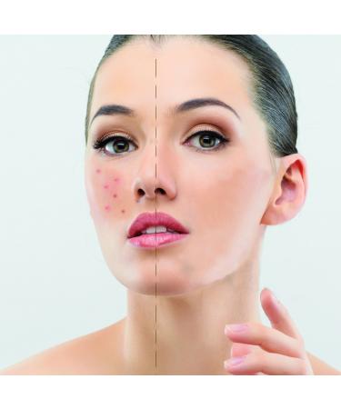 Ikos Dermaprof - Professional Make-Up Finish 30ml | International Shipping Available - Buy Online on GoSupps.com