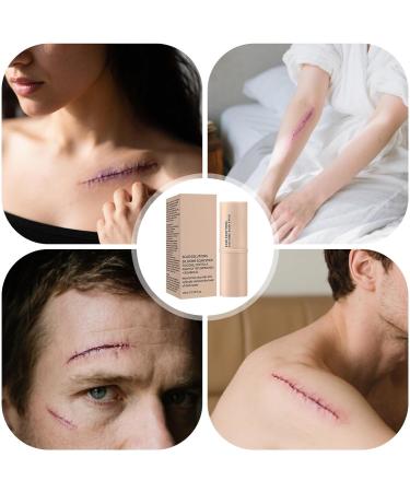 Silicone Scar Stick - 10ml Facial Extraction | Repair Word to Remove Skin Marks | 1.38 x 0.98 x 3.54 inches Keloid Trap Remover with Keloid - Buy Online on GoSupps.com