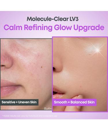 NINELESS Molecule-Clear 5% Mandelic Acid Serum - Korean Skincare Gentle AHA Exfoliating for Sensitive Skin - Panthenol Allantoin Sodium Hyaluronate - Hydrating Soothing Barrier Support 1.01 fl oz 03 Mandelic Acid (Bala  - Buy Online on GoSupps.com