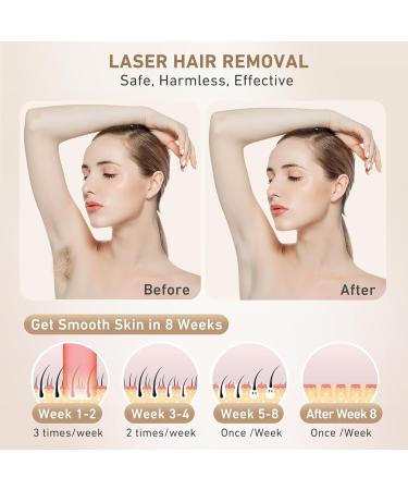 CURT IPL Hair Removal Device with Ice Cooling - 999,900 Light Pulses, 3 Functions, 5 Energy Levels - Permanent & Painless Hair Removal for Body, Legs, Armpits - White - Buy Online on GoSupps.com