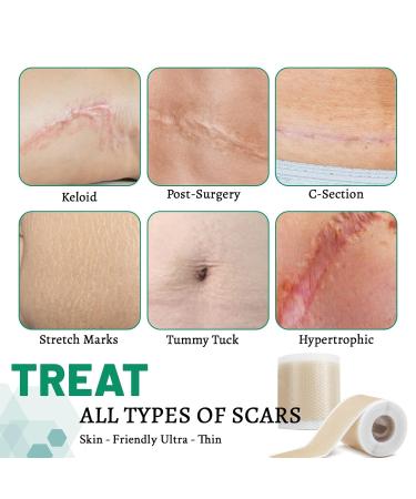3 Rolls Silicone Scar Sheets - Reusable Scar Removal Strips for Prevention & Repair | Light Brown Silicone Scar Tape - Buy Online on GoSupps.com