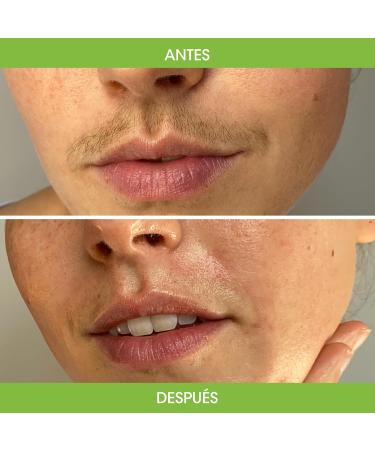  Nad's Nad's 20-Pack Hypoallergenic Facial Wax Strips for Women with 20 Wax Strips + 4 Soothing Oil Wipes - Buy Online on GoSupps.com