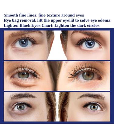 Instant Eye Lift Instant Firmx Eye Tightener Anti-wrinkle Anti-aging eye cream active eye cream eye serum targets under eye bags wrinkles dark circles and puffiness - Buy Online on GoSupps.com