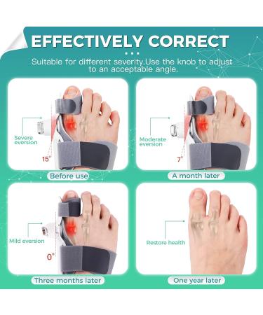 Moenmedic Bunion Corrector for Women and Men - Adjustable Toe Separator Straightener for Various Bunion Symptoms (1PC) - Buy Online on GoSupps.com