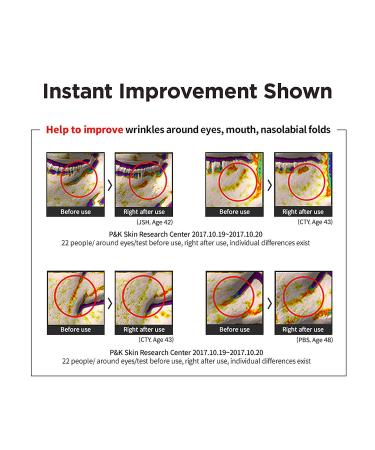 Easydew DW-EGF Cream 2.4 oz - Anti-Aging Moisturizer with Human Epidermal Growth Factor and Hyaluronic Acid | Collagen-Infused Lightweight Cream for Softer, Radiant Skin - Buy Online on GoSupps.com