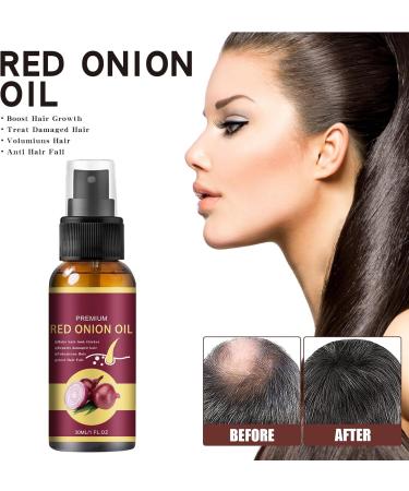  GNAUMORE Onion Hair Oil Essence for Hair Growth Fast Growth Hair Serum Anti-Hair Loss Serum for Women and Men Hair Regrowth Treatments 30 ml - Buy Online on GoSupps.com