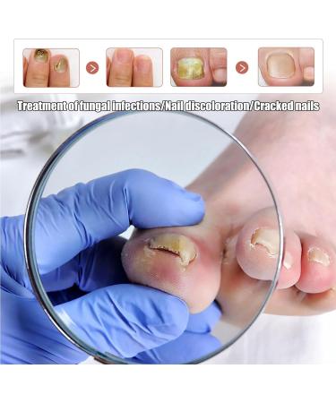 2 IN 1 Nail Fungus Treatment Oil - Fast Relief for Toenail Paronychia & Fungal Infections - Buy Online on GoSupps.com