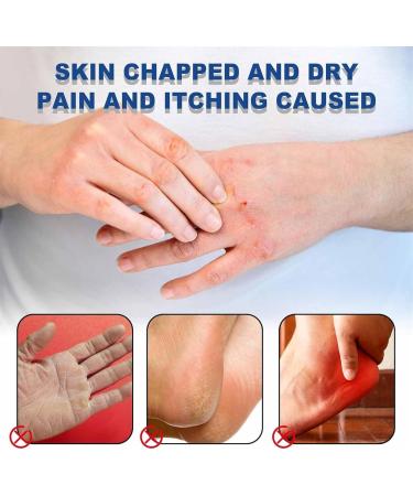 IFFANY Foot Balm Cream 40% Cracked Heel Repair Foot Cream Hard Skin Remover Foot Cream Removes Calluses and Rough Skin - Buy Online on GoSupps.com