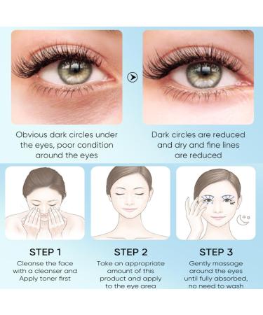 Hydrating Eye Cream 98 Percent Aloe Vera Moisturiser Under Eye Cream for Dark Circles and Puffy Eyes Repairing Tightening Reducing of Wrinkle Fine Lines Makes Skin Around Your Eyes Smooth & Shinny - Buy Online on GoSupps.com