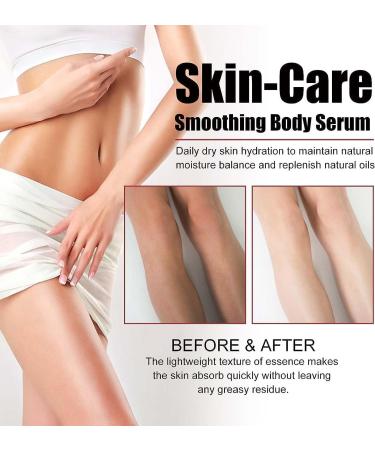  1/2/3Pcs B-Glossy Smoothing Body Serum Body Smoothing Serum for Silky Smooth Skin Smoothing Body Serum for Body Shaping and Cellulite Reduction Deep Moisturising Cream for Dry Heavy Body Skin Care 100ml/3.38fl.oz (2Count (Pack of 2)) - Buy Online on GoSupps.com