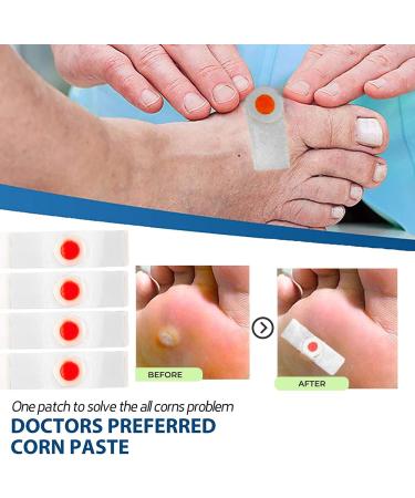 Mcvcoyh 35 Piece Corn Removal Pads - Corn Remover Treatment with Hole | Pain Relief for Corn Sufferers - Buy Online on GoSupps.com