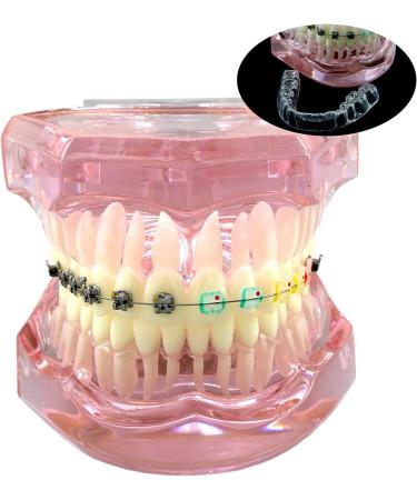 HDGRNCC Dental Orthodontic Brackets Model - Metal Ceramic Self-Ceramic Bracket for Training | International Shipping - Buy Online on GoSupps.com