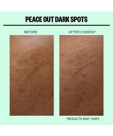 Peace Out Skincare Dark Spot Microneedling Dots - 12 Dots for Clear, Even Skin - Buy Online on GoSupps.com