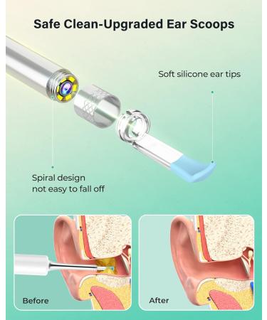 Xlife Ear Wax Removal 1080P HD Camera & Blackhead Remover Kit - Ear Cleaner for iPhone, iPad & Android - 3.5mm Ultra-Thin Lens - C3 White - Buy Online on GoSupps.com
