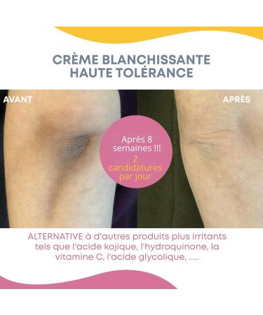  Gynebal GYNEBAL Depigmenting Cream with Niacinamide Lightening Anti-Spot and Gentle Intimate and Sensitive Areas Underarms Groin Elbows Knees Hands and Melasma 30 ml - Buy Online on GoSupps.com
