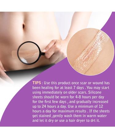 Soothing Silicone Scar Sheets Roll for C-Section, Surgery, Burns, Acne, Stretch Marks - 1.6 x 120 in - Reusable & Effective - Keloid Reduction - Buy Online on GoSupps.com