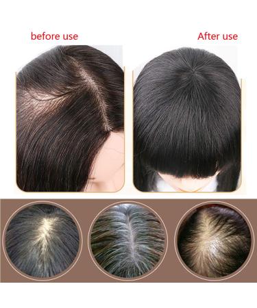 100% Human Hair Topper - Clip-in Hairpiece for Women | Thickening Lace Wig for Natural Look - Buy Online on GoSupps.com