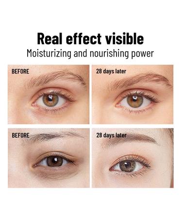 OUKEYA Dark Circle & Puffiness Eye Cream with Caffeine, Vitamin E, Argireline & Pro-Xylane - Anti-Aging Line Smoothing Treatment (0.5Fl Oz) - Buy Online on GoSupps.com