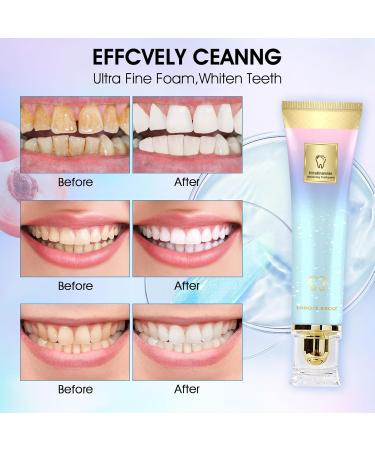 2PCS Niacinamide Whitening Toothpaste Niacinamide Toothpaste Whitening Teeth Fresh Breath Remove Tooth Stains - Buy Online on GoSupps.com