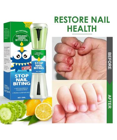 Plant-Extract Nail Biting and Thumb Sucking Treatment - Stop Bad Habits Naturally - Nail Care Formula 0.35 Fl Oz - Buy Online on GoSupps.com