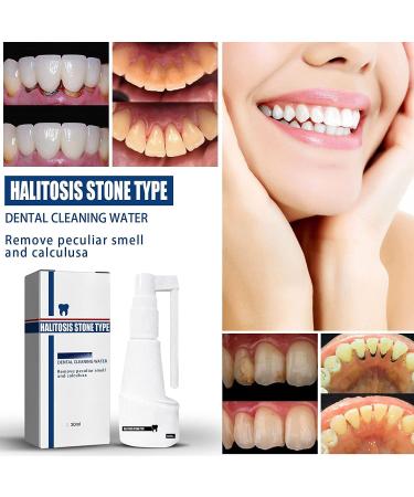 Calculusfree Dissolving Dental Spray - Powerful Dental Calculus Remover & Mouth Refreshing Spray (3 PCs) | Intensive Stain Removal for Clean Teeth - Buy Online on GoSupps.com