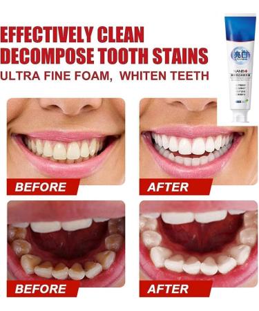sjfscqr Probiotic Fast Whitening Toothpaste Ultra Whitening Toothpaste for Fresh Breath SP-4 Whitening and Stain Removal Toothpaste - Buy Online on GoSupps.com