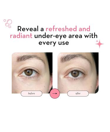 Elizabeth Mott 24K Gold Under Eye Patches - Hydrating & Brightening Eye Mask with Collagen Niacinamide & Peptides | Perfect Gifts for Women - Cruelty Free - Buy Online on GoSupps.com