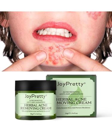 Effective Acne Treatment Face Cream | Herbal Spot Treatment for Teens & Adults | Remove Acne Marks & Moisturize Skin - Buy Online on GoSupps.com