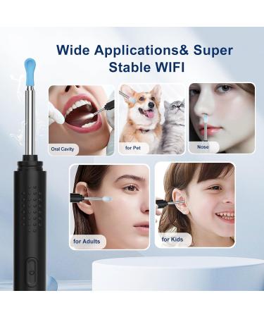 Premium Ear Wax Removal Kit with Camera 1296P HD 9 Ear Picks & 8 Tools Wireless & Waterproof Compatible with iPhone iPad Android - Buy Online on GoSupps.com