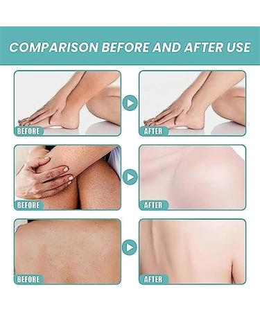 sjfscqr Original Skin So Soft Bath Oil Moisturizing Skin Smoothing and Softening Dry or Rough Skin Bath Oil for Smooth Skin for Women and Men - Buy Online on GoSupps.com