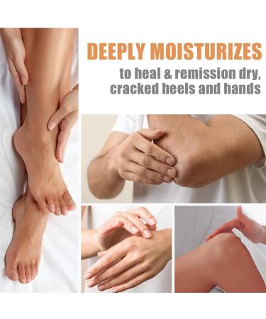  G n rique Dry Feet Cream Softening Heels Lotion 40 ml Soothing Hand Foot Care Moisturizer for Cracked Skin on Heels Knees Elbows Nourishing Daily Repair Solution - Buy Online on GoSupps.com