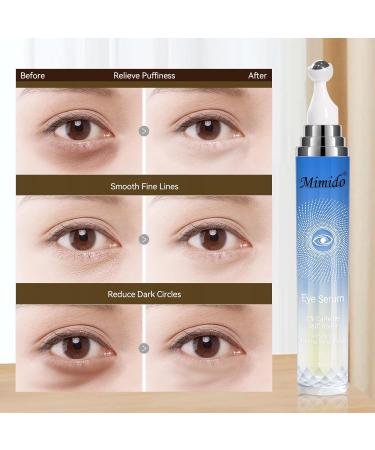 Caffeine Eye Cream - Hydrating Under Eye Cream 0.71fl.oz | Brighten & Revitalize Dark Circles | International Shipping - Buy Online on GoSupps.com