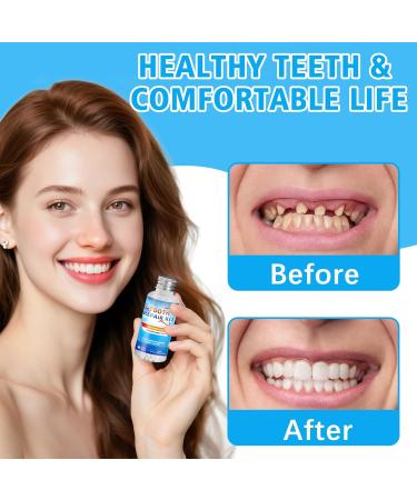 Moldable False Teeth Beads DIY Temporary Tooth Replacement Kit Suitable for Missing Broken and Chipped Tooth Repair Beads Thermoplastic Beads Make You Smile Confidently-Q1Q - Buy Online on GoSupps.com